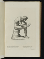 Statue eines jungen Mannes, einen Dorn aus seinem Fuß ziehend
